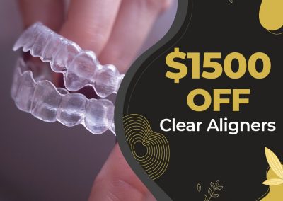 1500 off clear aligners